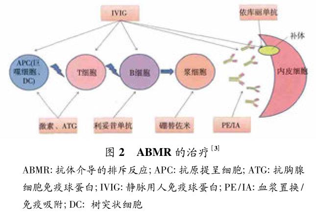 2 移植肾抗体介导的排斥反应的诊治新进展.jpg