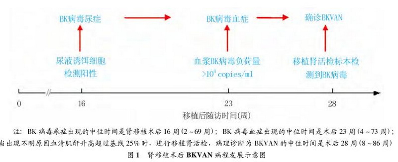 肾移植术后BK病毒相关性肾病的临床诊治研究进展.jpg