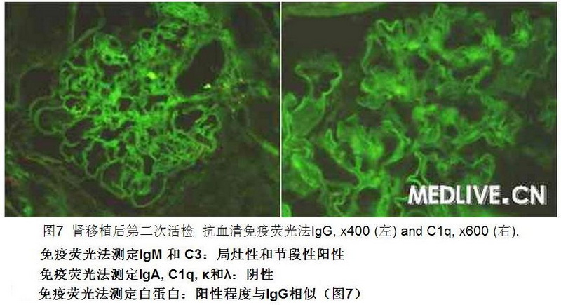 7 病例诊断—肾移植1年后供体肾功能障碍.jpg