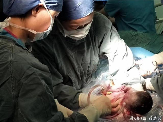 女子肾移植8年后喜得千金 2.jpg
