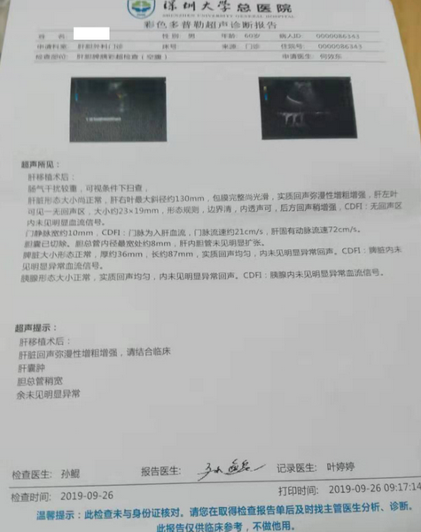 彩超.png