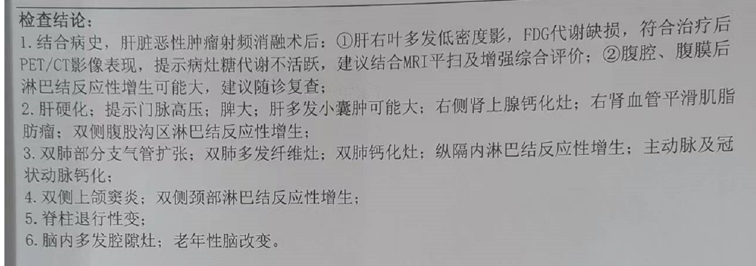 10月19日pet-ct