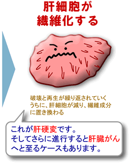 肝移植的卡通、logo等，欢迎大家继续提供