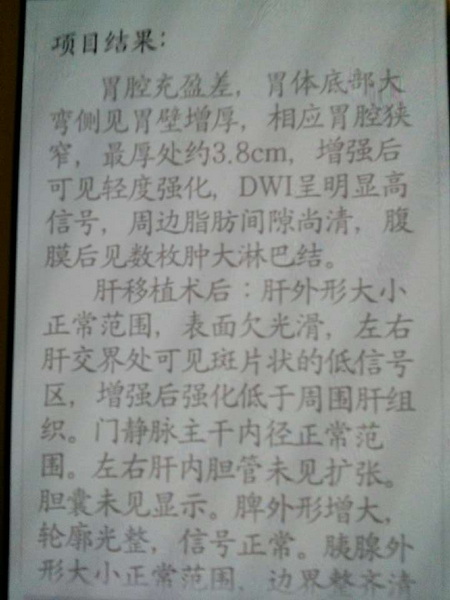 胃磁共振