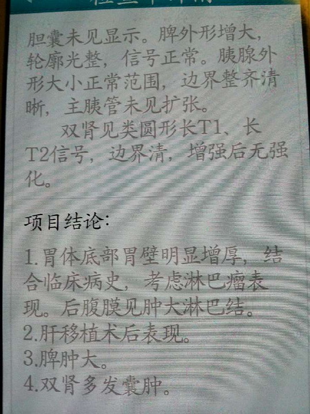 胃磁共振