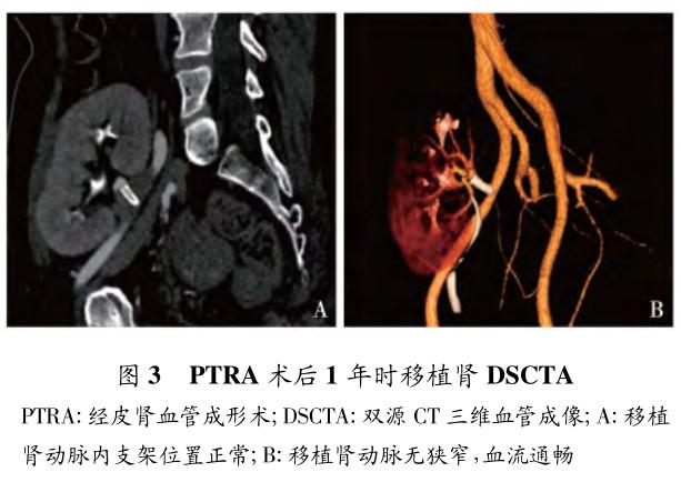 移植肾动脉狭窄的早期诊治策略及疗效评价 图3.jpg