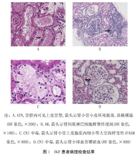 1 移植肾功能延迟恢复的病理变化与中医证型关系.jpg