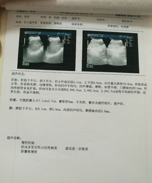 mmexport1484183359611.jpg