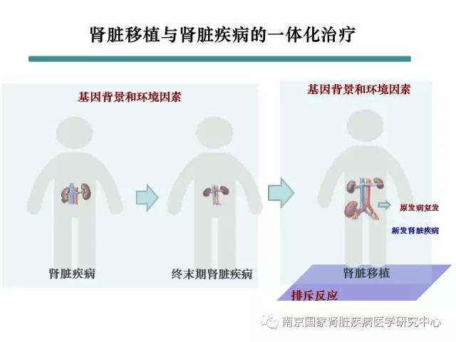 2 肾脏移植与肾脏疾病的一体化治疗.webp.jpg