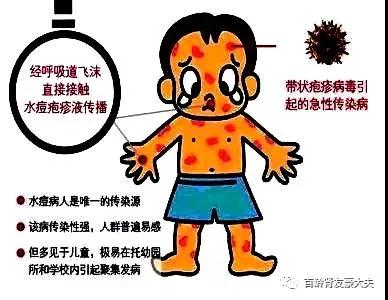 111200xa66vzj3tmz0kvjb.jpg