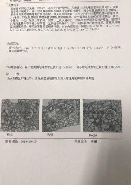 移植肾穿刺