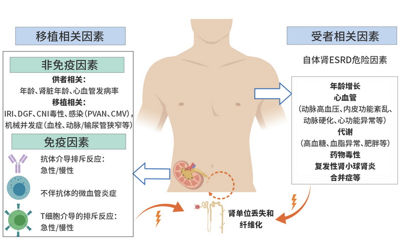 图1 移植物丢失危险因素.jpg