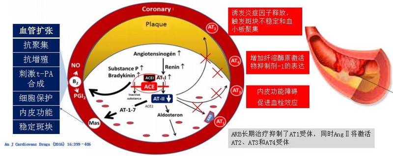 图2 ACEI与ARB对心血管保护的不同作用机制.jpg