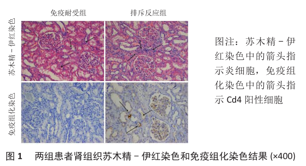 图1 两组患者肾组织苏木精-伊红染色和免疫组化染色结果.png