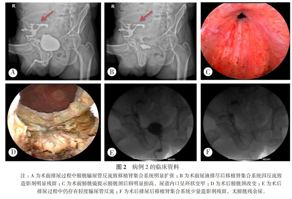 图2 病例2的临床资料.jpg