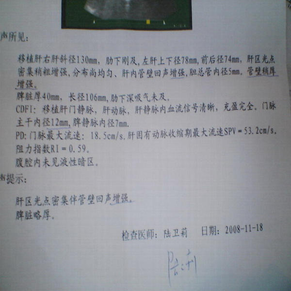 烦请帮我看一下彩超