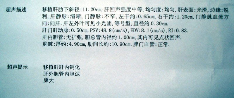 请各位专家、朋友帮忙看看我的超声报告！！！