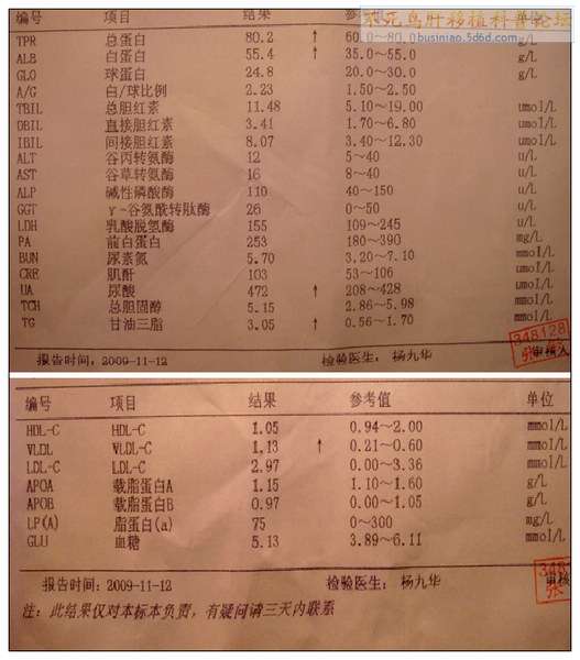 急求助——是不是乙肝复发了？