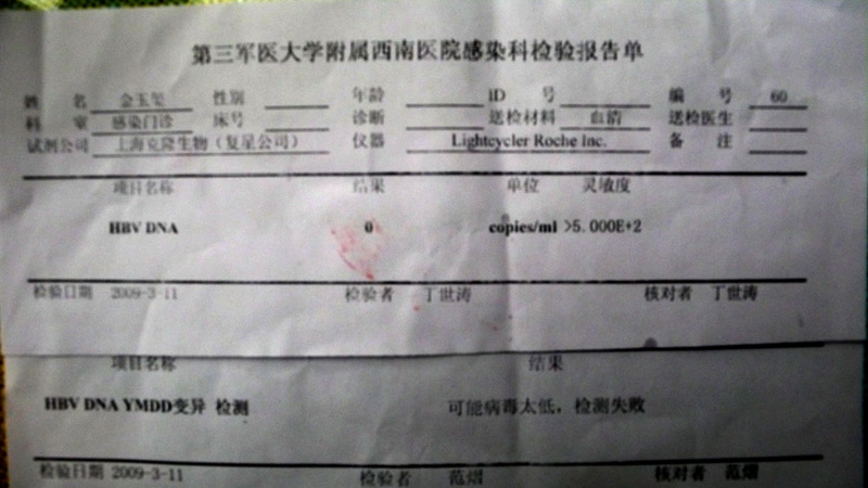 四年多来第一次肝功异常，请专家支招