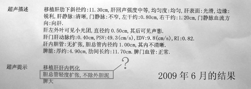 超声结果出来了有点懵！请各位专家和朋友帮忙看看！