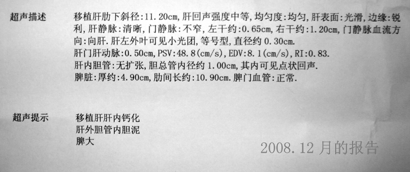 超声结果出来了有点懵！请各位专家和朋友帮忙看看！
