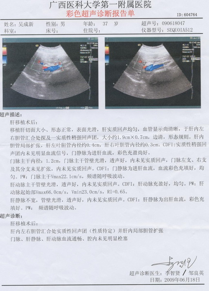B超结果及转氨酶