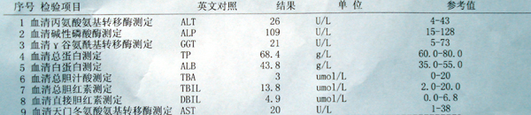 hpP5HlKN.jpg