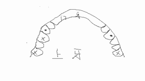 [求助]牙师请教牙医