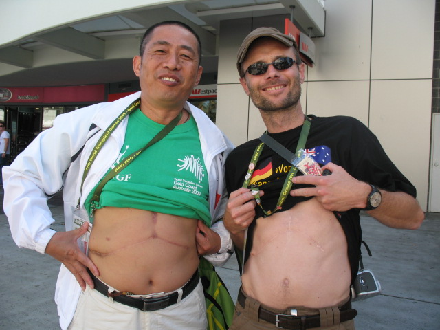 2009国庆预演－肝友方阵