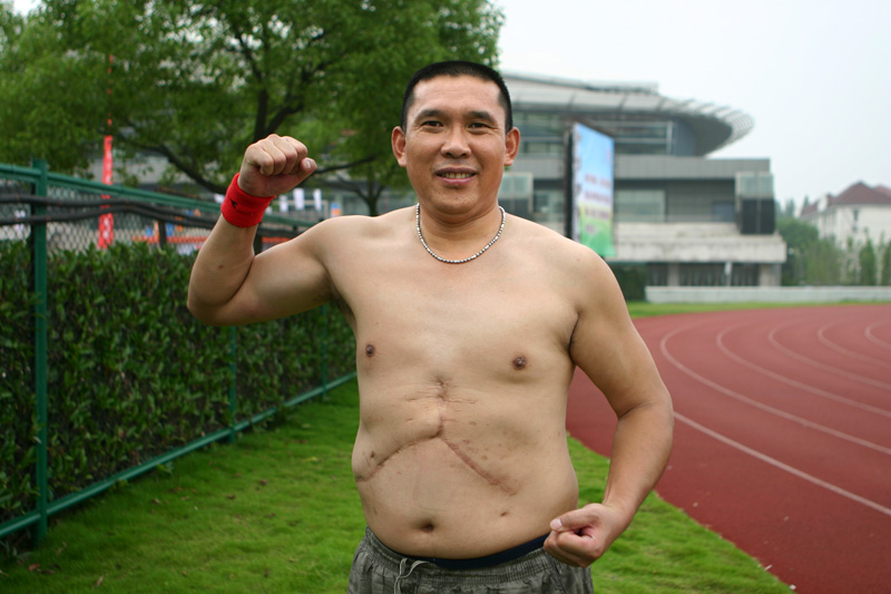2009国庆预演－肝友方阵