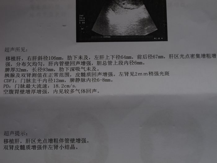烦请帮我看一下彩超
