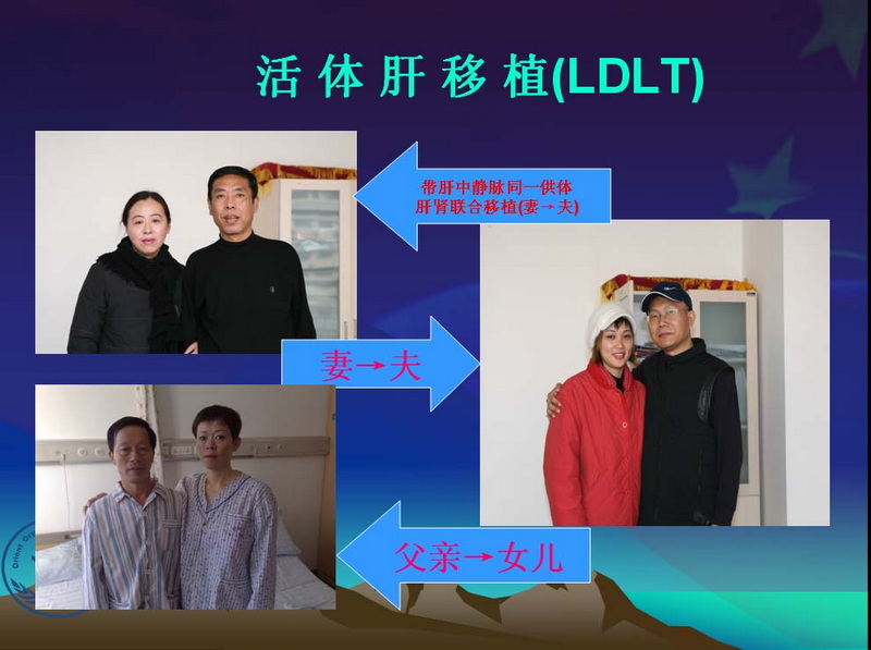 凤凰社肝移植长期生存交流会专家讲座提要