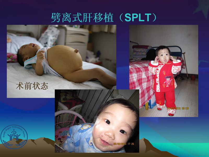 凤凰社肝移植长期生存交流会专家讲座提要