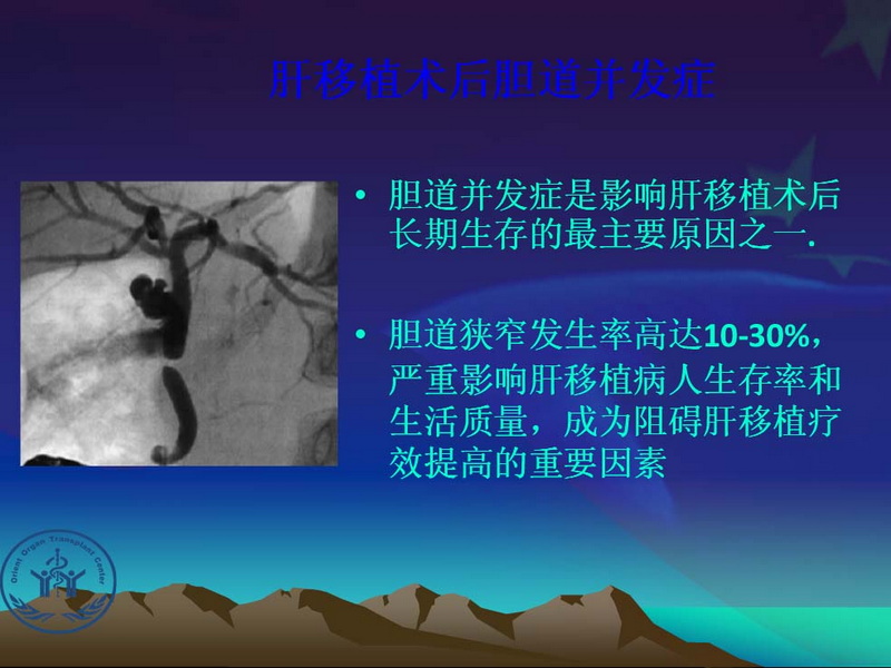 天一中心凤凰社肝移植长期生存交流会专家讲座提要